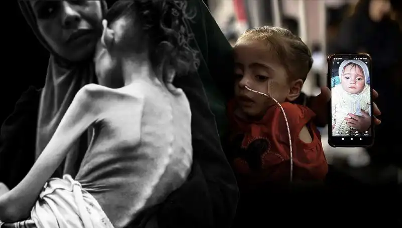 Meryem’in Hayatta Kalma Mücadelesi: 25 Kilodan 10 Kiloya Düştü