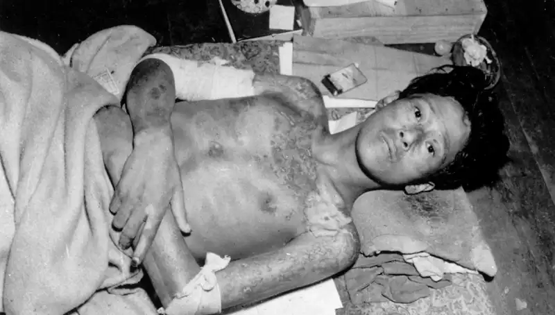 80 Yıl Sonra Nagasaki'den Gelen Uyarı: Nükleer Tehdit Yeniden Gündemde
